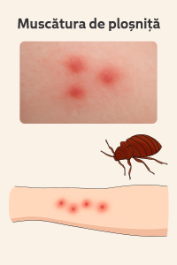 Muscatura plosnita